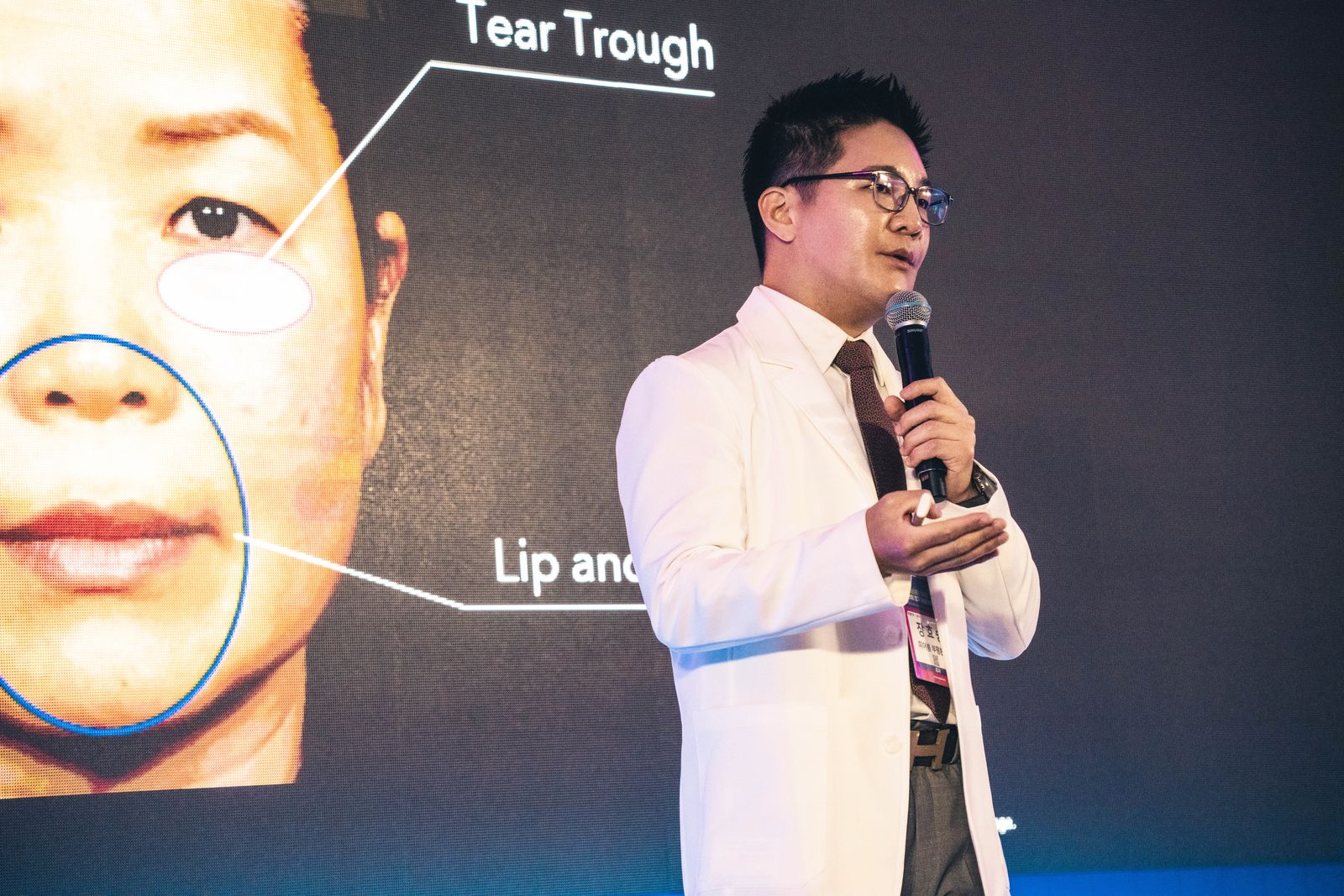 第18回 定期学術大会：目の下（ティアトラフ）の解剖学の講演